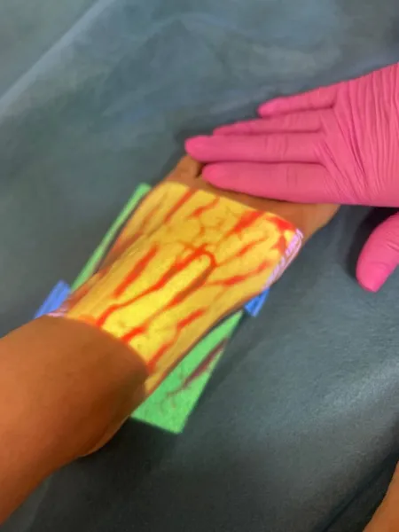 VENOSCANNER Qualmedi QV-600 Vein Finder - device for locating veins | New equipment