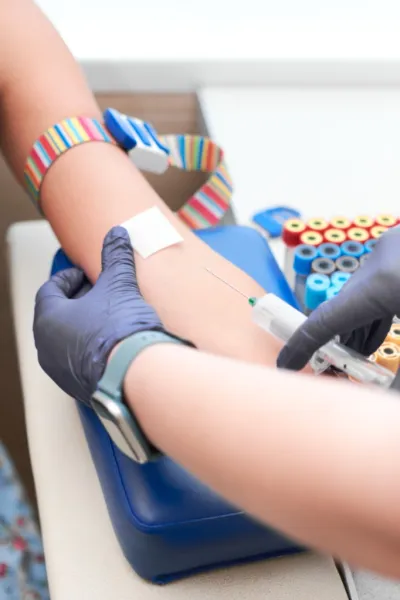 Studi immunologici complessi | Studi immunologici