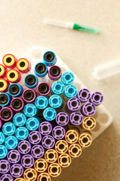 Studi immunologici del sangue | Studi immunologici