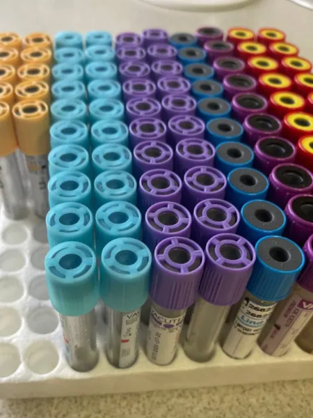 Esame delle feci | Indagini batteriologiche