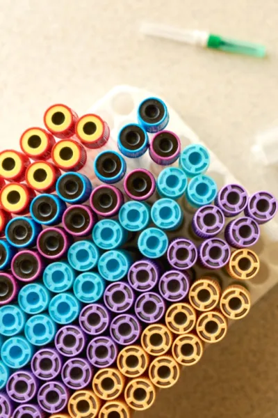 Ricerca del geomostasi, коагулометрия | Indicatori di emostasi, coagulometria.