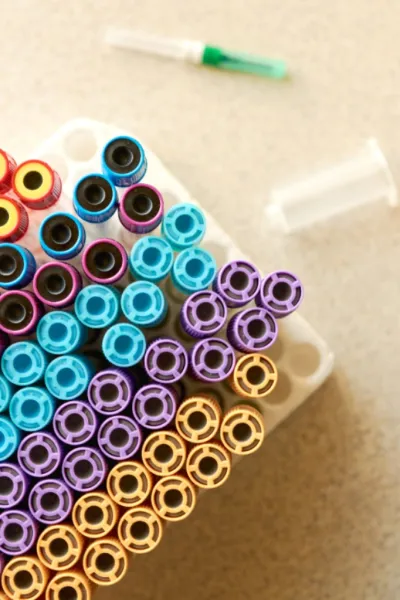 Complesso renale | RICERCHE BIOCHIMICHE