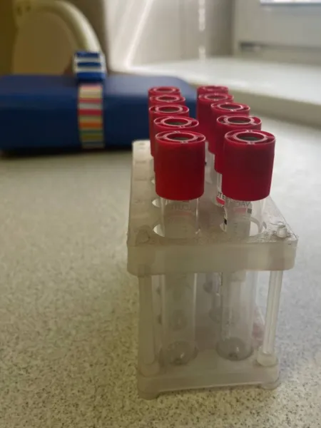 Test avanzati dell'emostasi | Indicatori di emostasi, coagulometria.