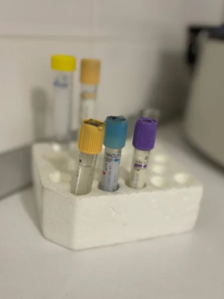 Pосев мазка (из зева, носа, ран, половых путей) | Indagini batteriologiche