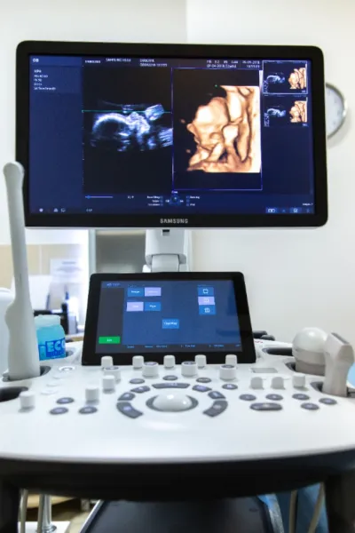 Середній акушерський скринінг (2 триместр): | УЗД ВАГІТНИХ