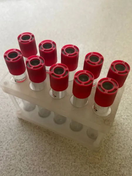 Diagnostica prenatale | Ormoni