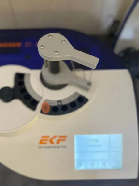 Metabolismo dei carboidrati e диабет | RICERCHE BIOCHIMICHE