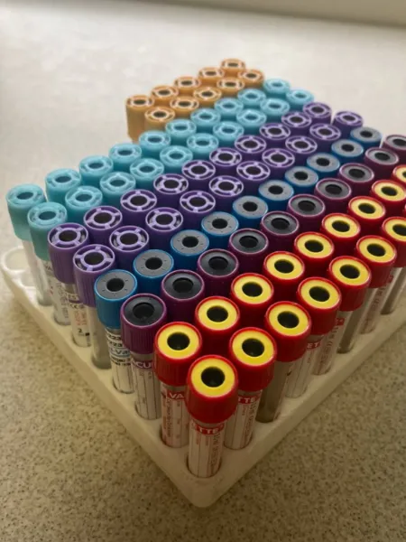 Esame del sangue | Indagini batteriologiche