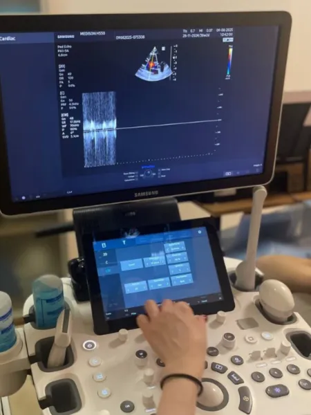 УЗД серця (ехокардіографія) дорослим | УЗД СЕРЦЯ ДОРОСЛИМ І ДІТЯМ