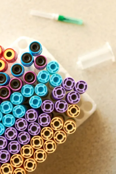 Analisi per infezioni urogenitali | Ricerche sulle infezioni