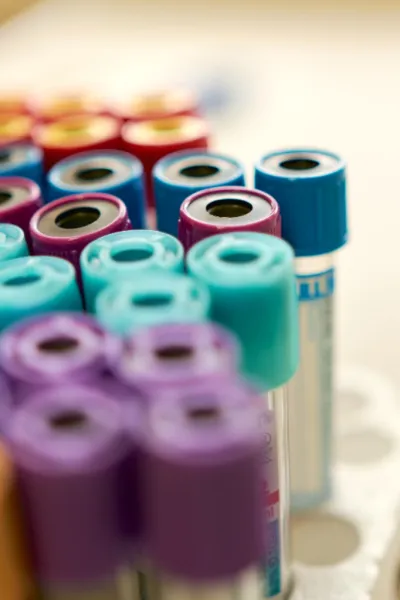 Analisi del sangue per infezioni TORCH | Ricerche sulle infezioni