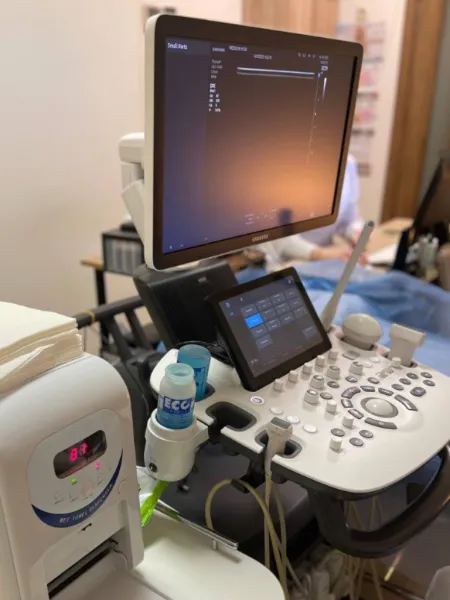 Research of salivary glands | Ultrasound of the salivary glands