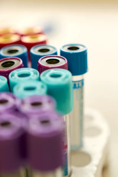 Исследование мочи | КЛИНИЧЕСКИЕ ИССЛЕДОВАНИЯ