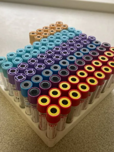 Онкомаркер молочной железы (CA 15-3) | Marcatori tumorali