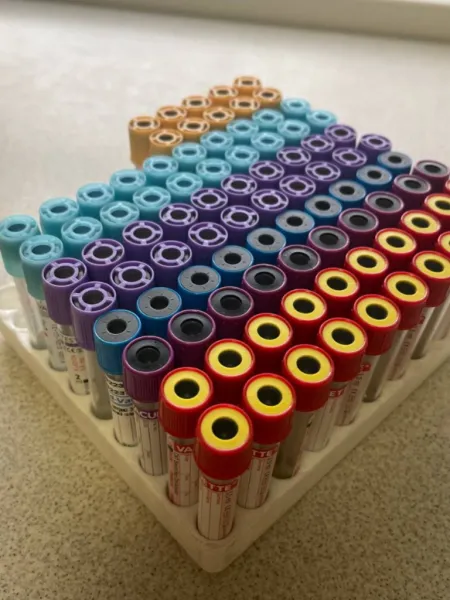 Tossicologia e metalli pesanti | RICERCHE BIOCHIMICHE