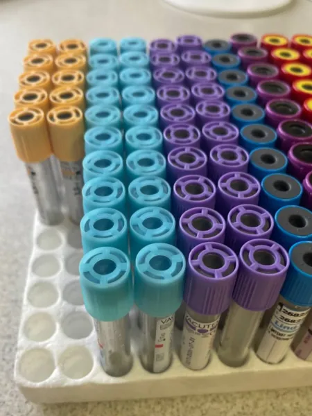 Diagnostica delle malattie autoimmuni | Studi immunologici