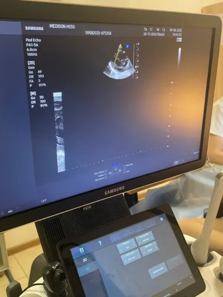 УЗД мошонки | УЗД СТАТЕВОЇ СИСТЕМИ У ЧОЛОВІКІВ